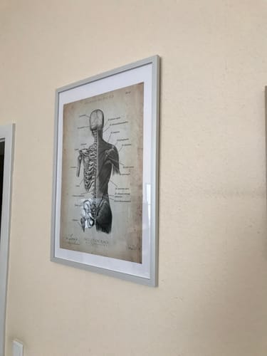 Customer photo review of Back Anatomy | Bones and Muscles