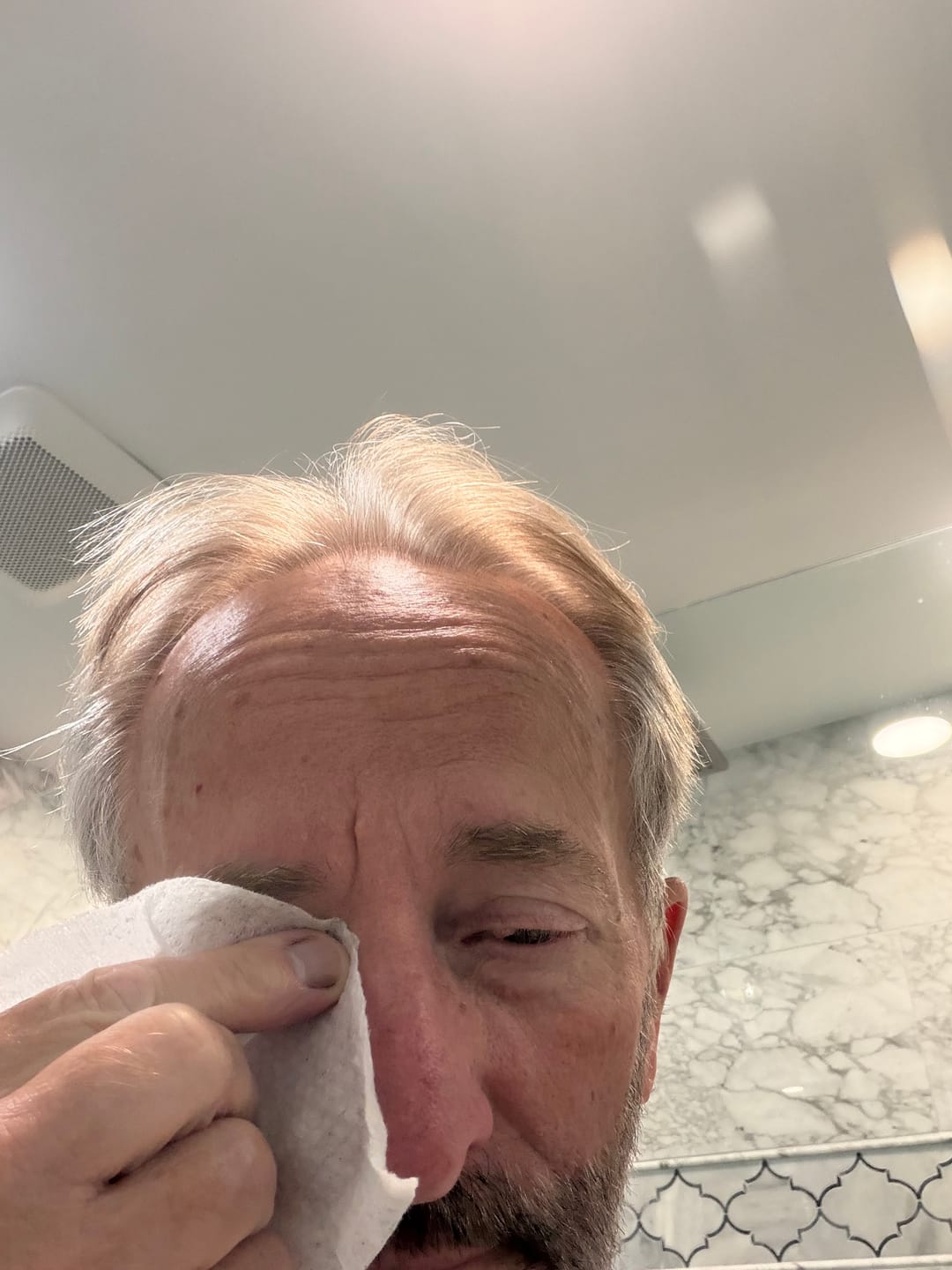 Customer photo review of The Daily Lid Wipe™ - 30count