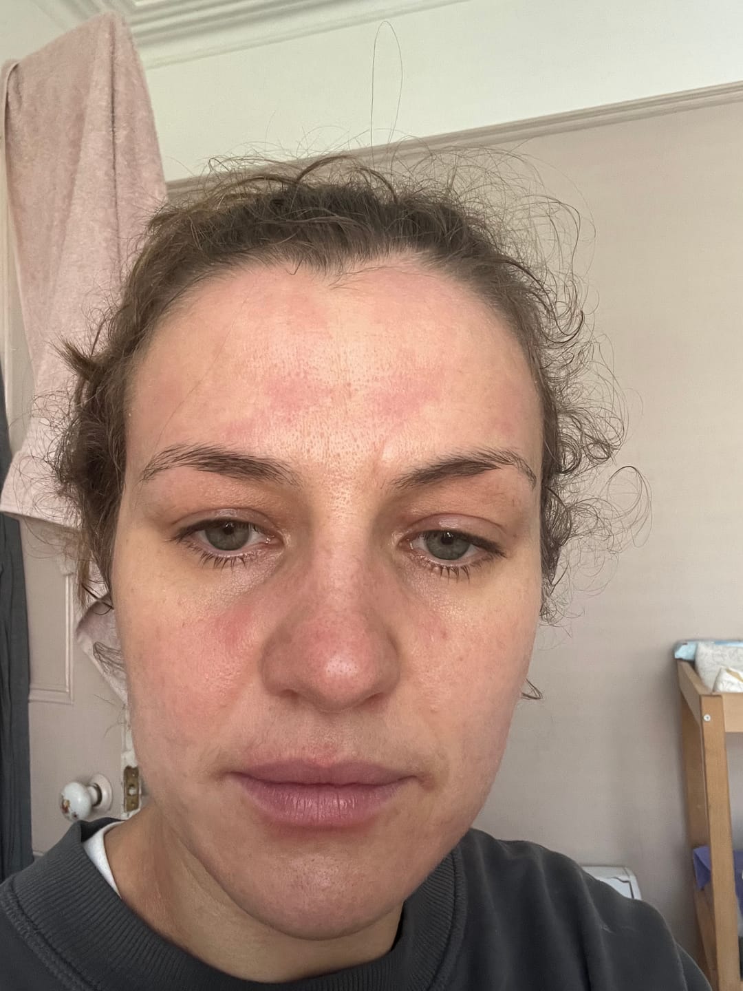 Customer photo review of Grass-Fed Collagen Peptides