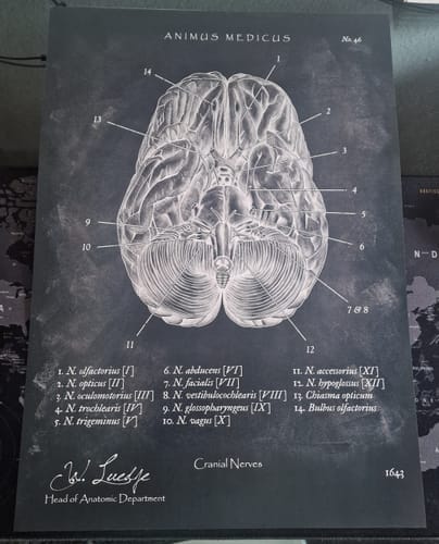 Customer photo review of Die 12 Hirnnerven - Chalkboard