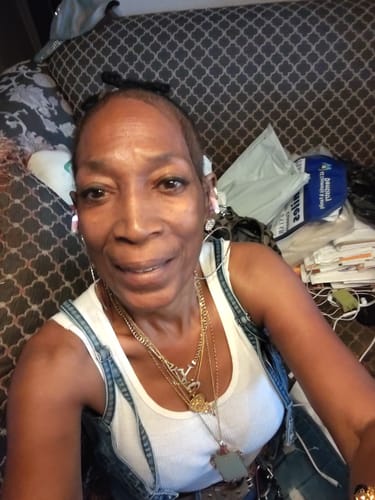 Customer photo review of Hair ReGrowth Serum - Best Friend Kit