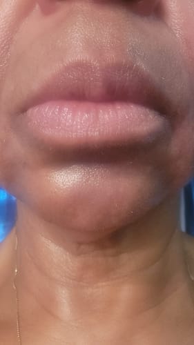 Customer photo review of Infusion Enhancement Bundle