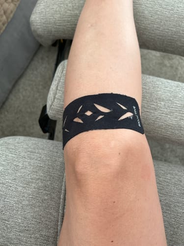 Customer photo review of Easy Kinesiology Tape