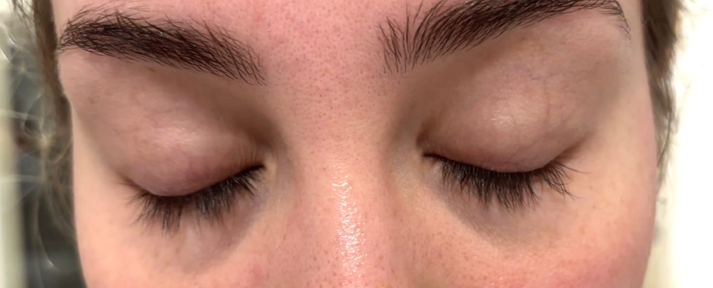 Customer photo review of Lash Rehab Eyelash Growth Serum – Clinically Proven (3ml)