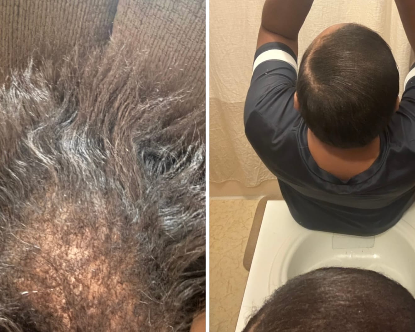 Customer photo review of 2 oz HAIR & SCALP GROWTH OIL
