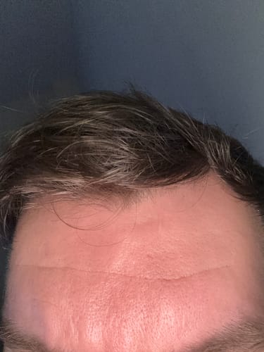 Customer photo review of Seb Natural Calming Serum