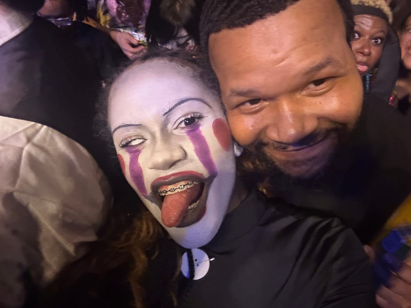 Customer photo review of Halloween White out Colored Contact Lenses