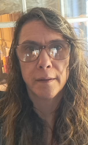 Customer photo review of The Micro Infusion System™