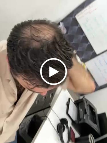 Customer video review of Shampoo de Biotina HAIRtamin