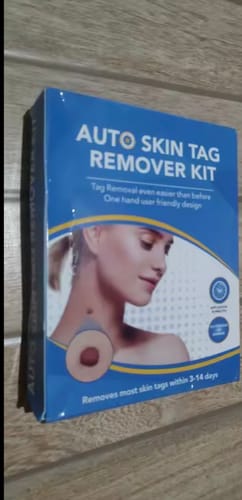 Customer photo review of Nie wieder Hautanhängsel