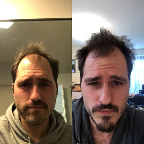 Avis photo d'un client sur Pack - Chauve Qui Peut