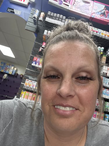 Customer photo review of Pop On Veneers with Impression Kit