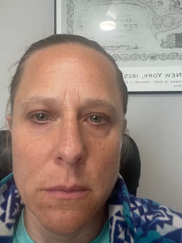 Customer photo review of Grass Fed Tallow & Honey Balm