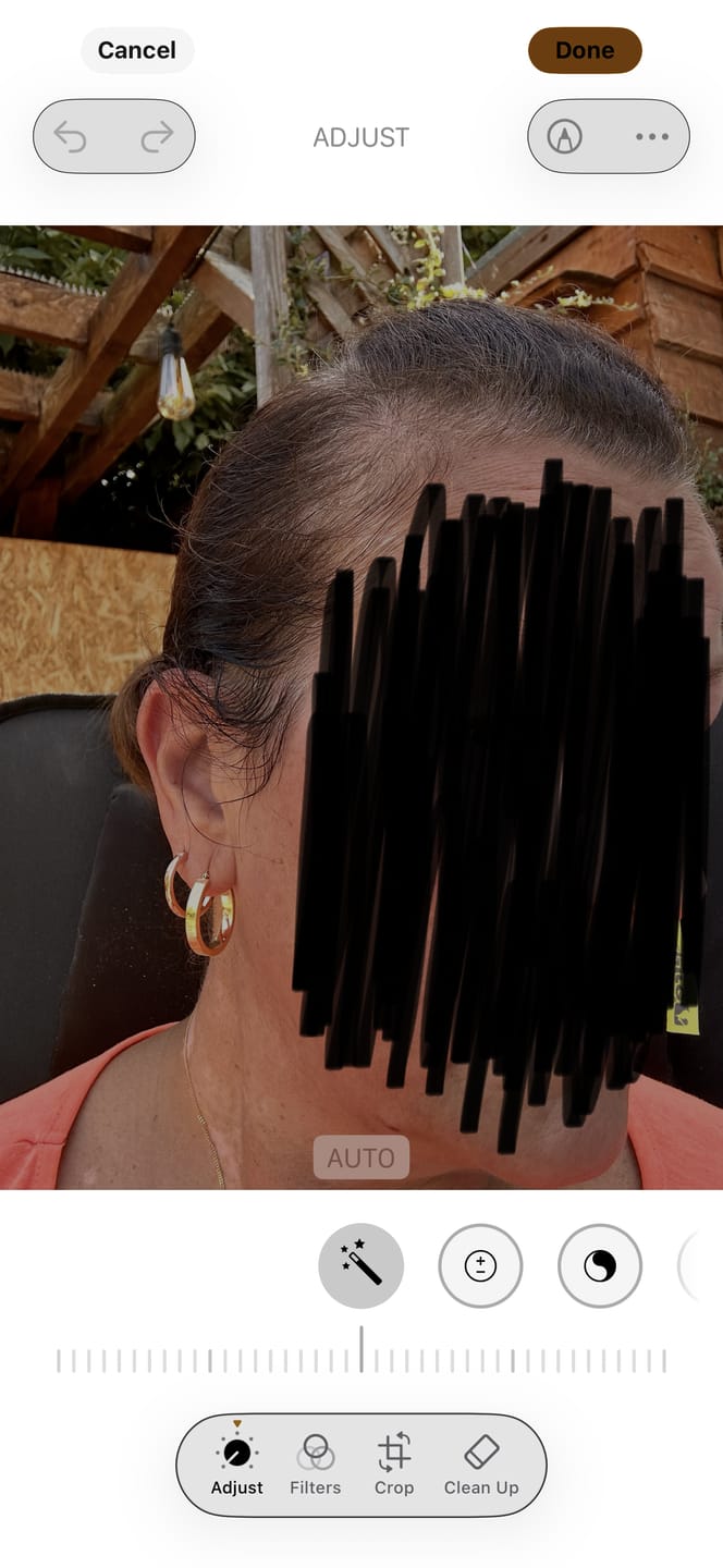 Customer photo review of Complex10™ Hair Growth Supplement