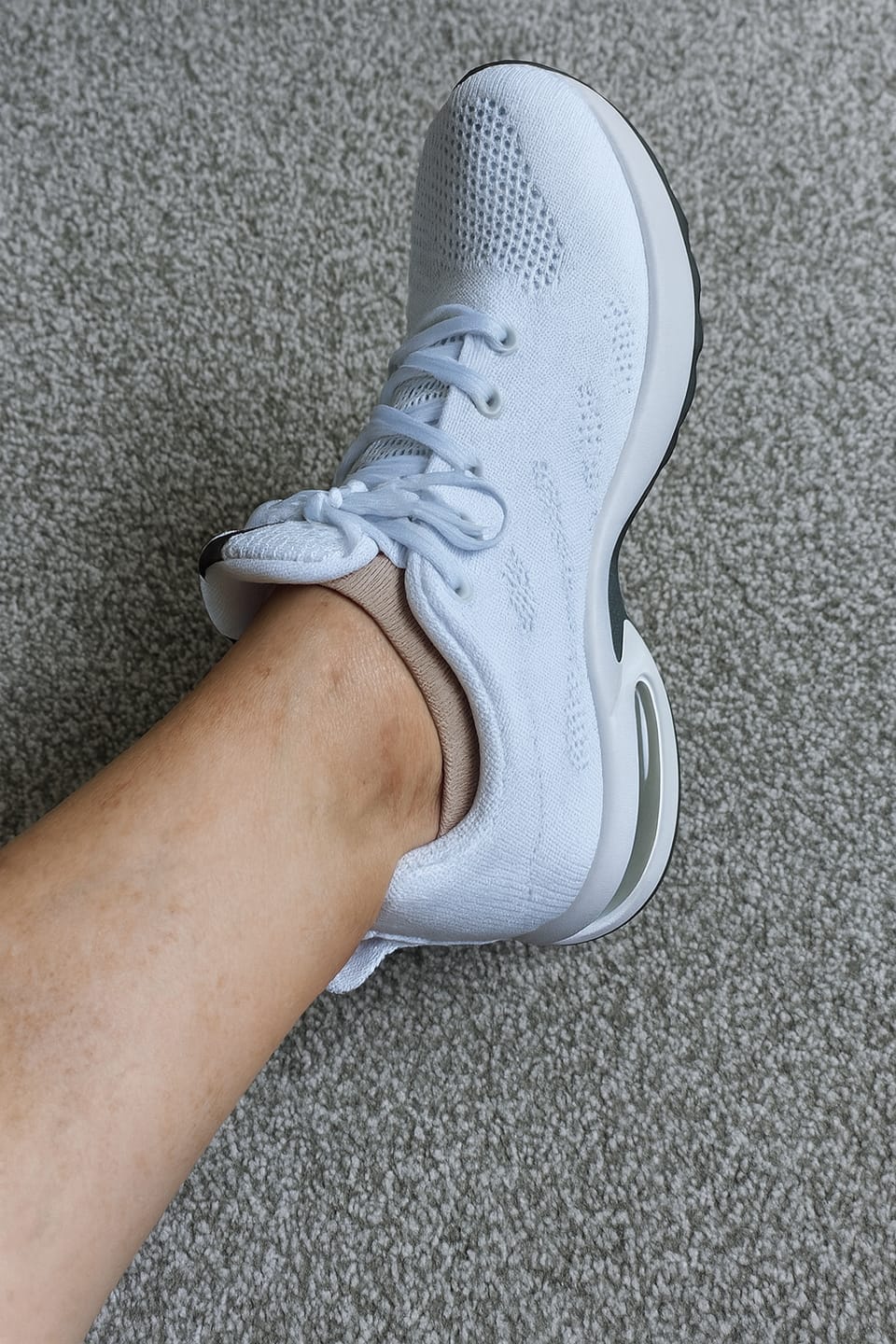 Customer photo review of OrthoCare™ - All-Day Comfort & Pain-Free Orthopedic Shoes