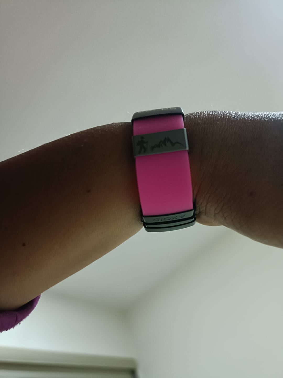 Customer photo review of Bandas Para AxoID