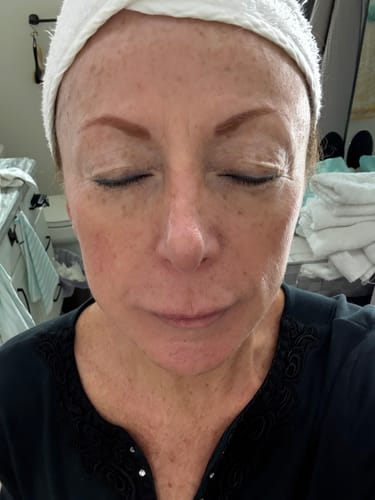 Customer photo review of Pigment Brightening Serum