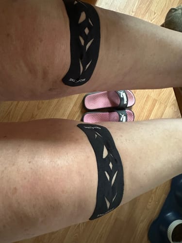 Customer photo review of Easy Kinesiology Tape