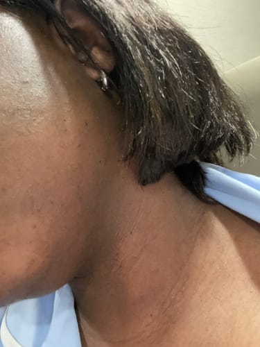 Customer photo review of Turmeric Glow Soap