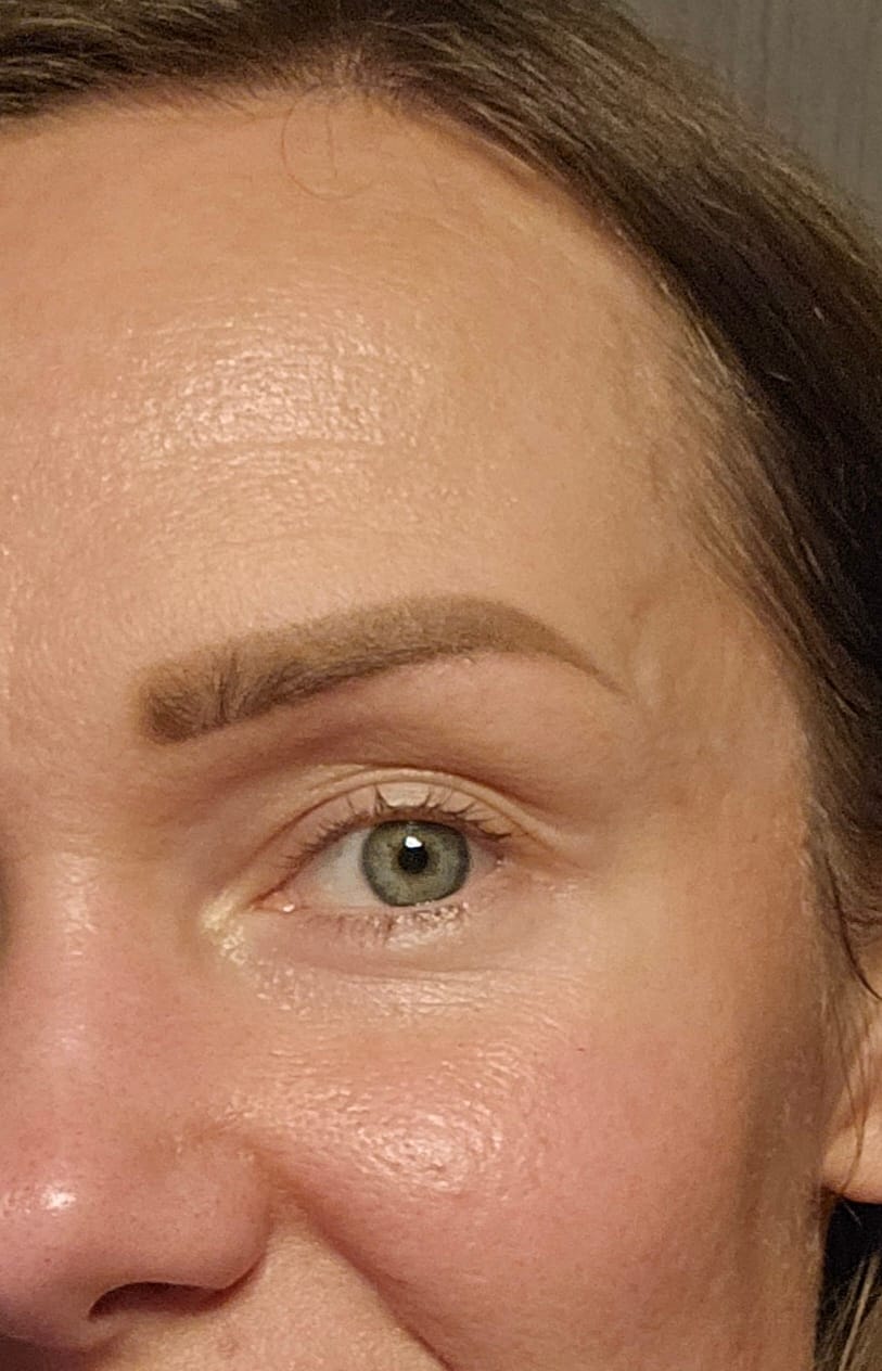 Customer photo review of Let's Glow Cream 5ml