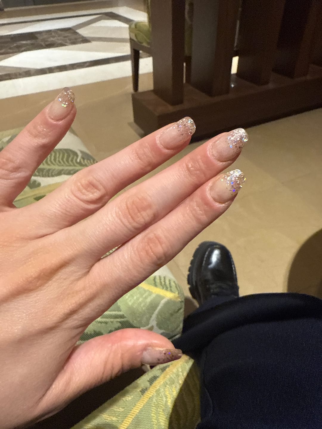 Customer photo review of N Sparkle Glam Jel Tırnak 30 Adet, 2 Kullanım
