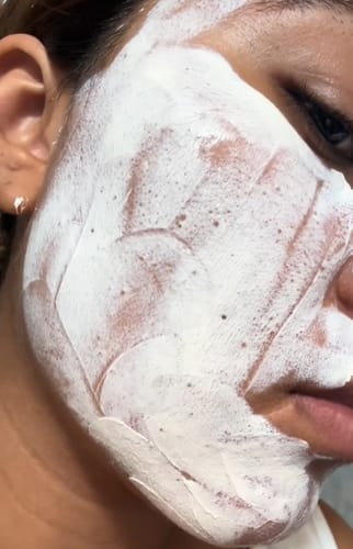 Customer photo review of Mascarilla de Arcilla con 3 Ácidos para Limpieza Profunda de Poros