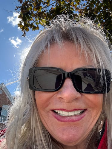 Customer photo review of Pop On Veneers - Custom Made Production