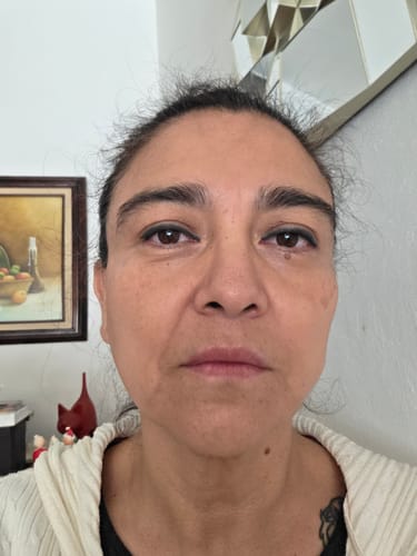 Customer photo review of Kit Piel Deslumbrante (47% OFF) - Limpiador + Tónico + Serum Vitamina C + Serum Niacinamida + Serum Ácido Glicólico + Serum Ácido Hialurónico + Contorno de Ojos