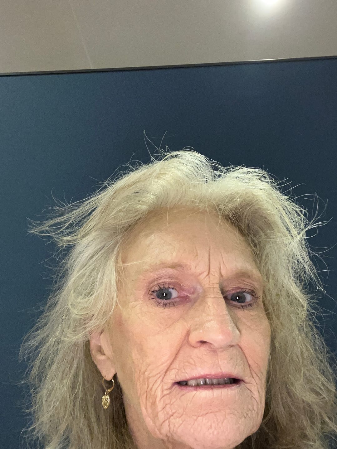 Customer photo review of Hair Growth Serum