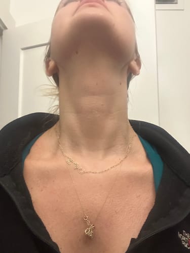 Customer photo review of Grass Fed Tallow & Honey Balm