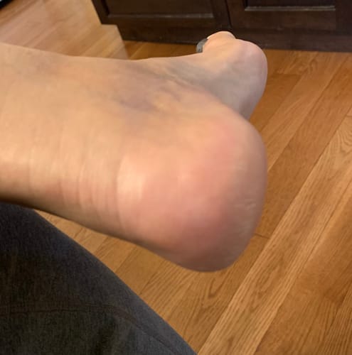 Customer photo review of Body Serum