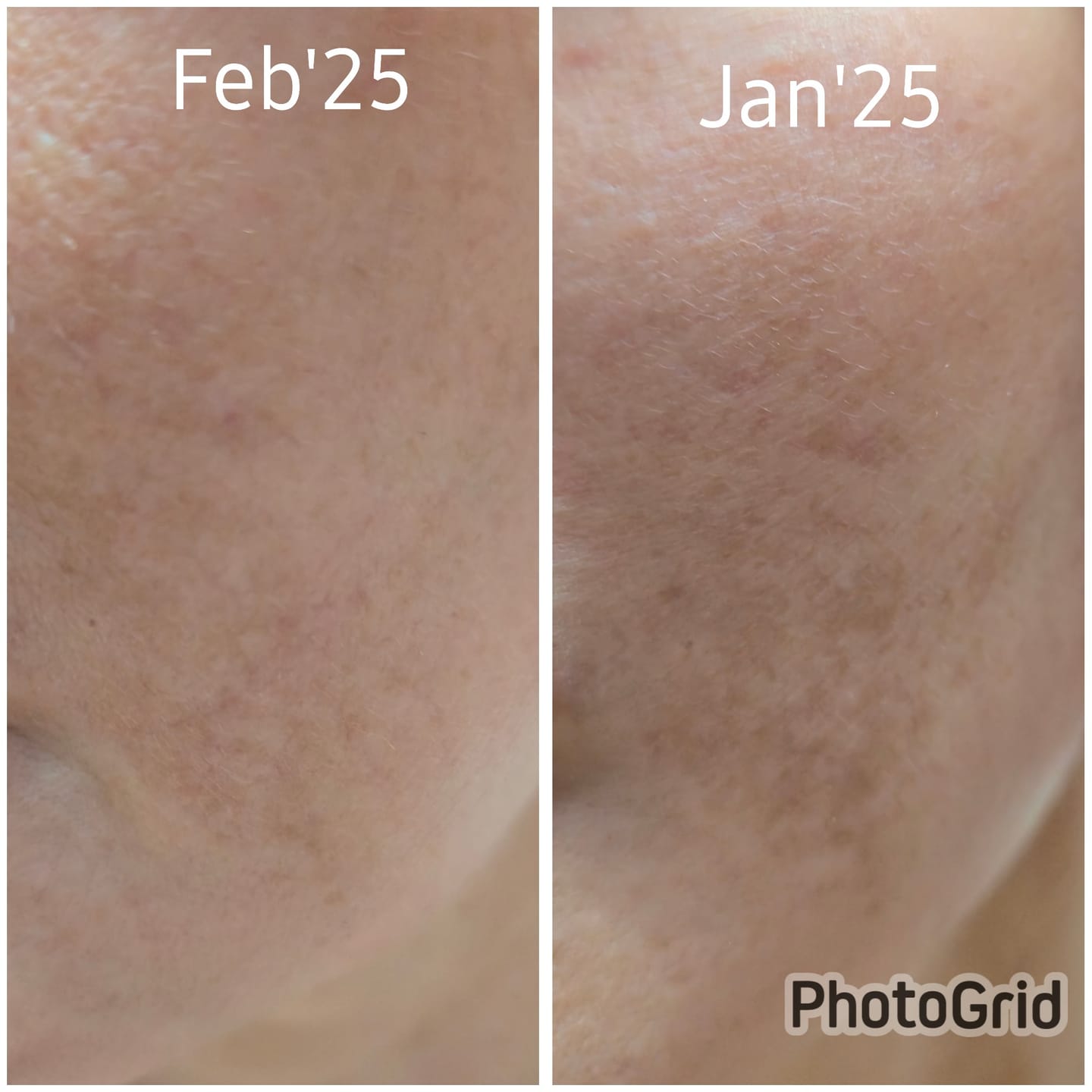 Customer photo review of Ventamin Light Up™