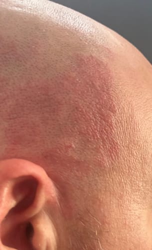 Customer photo review of Seb Natural Calming Serum