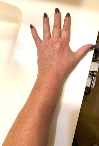 Customer photo review of Body Serum