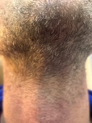 Customer photo review of Seb Natural Calming Serum