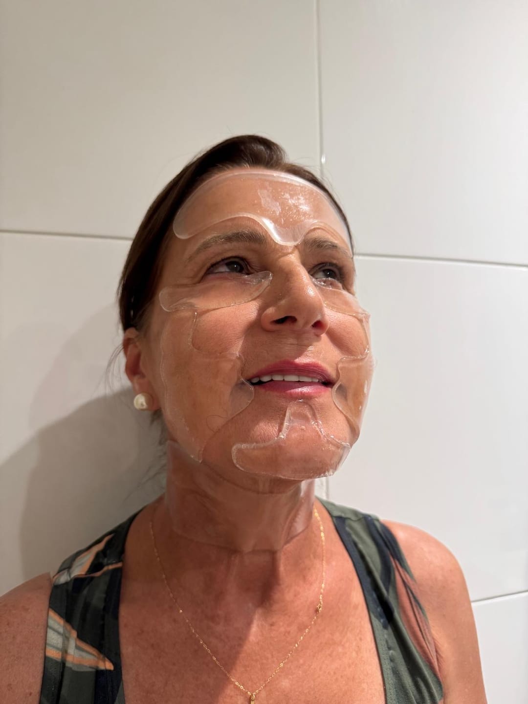 Customer photo review of Full Face Silicone Patch Kit