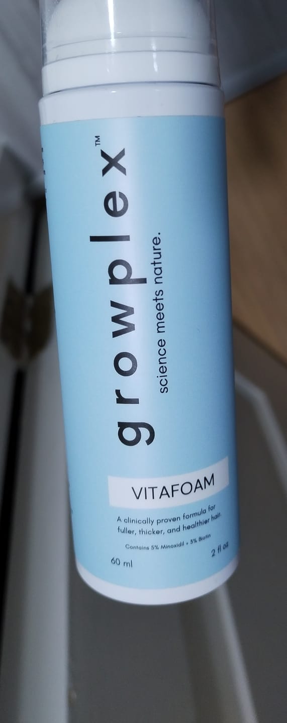 Customer photo review of Hair Loss Prevention Kit