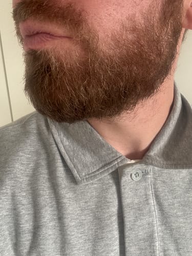 Customer photo review of Seb Natural Calming Serum