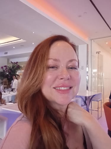 Customer photo review of FaceFix: Sculptra