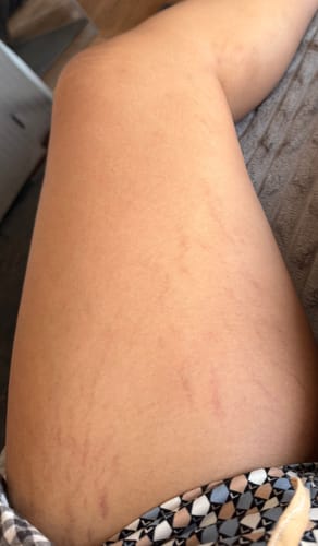 Customer photo review of Easy Tiger