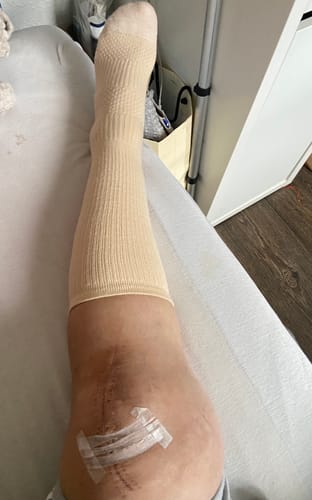 Customer photo review of Støttestrømper