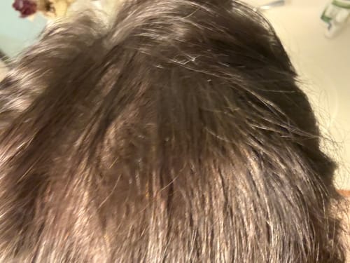 Customer photo review of Glov Hair Regrowth System