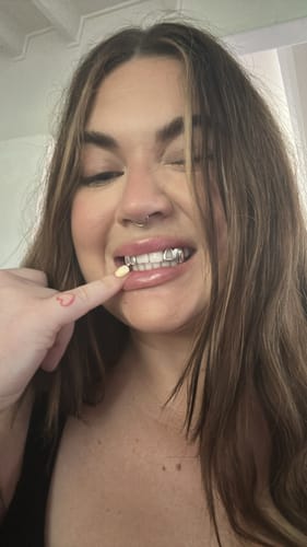 Customer photo review of PRISM (SILVER GRILLZ)