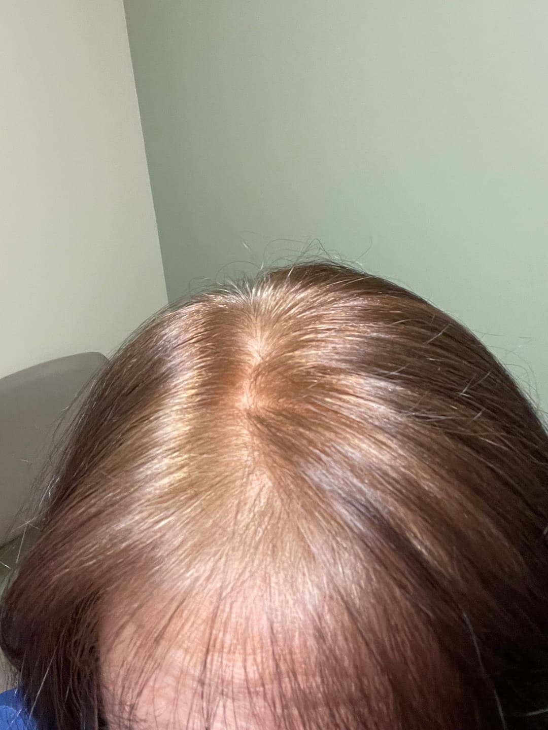 Customer photo review of Instant Dye Shampoo