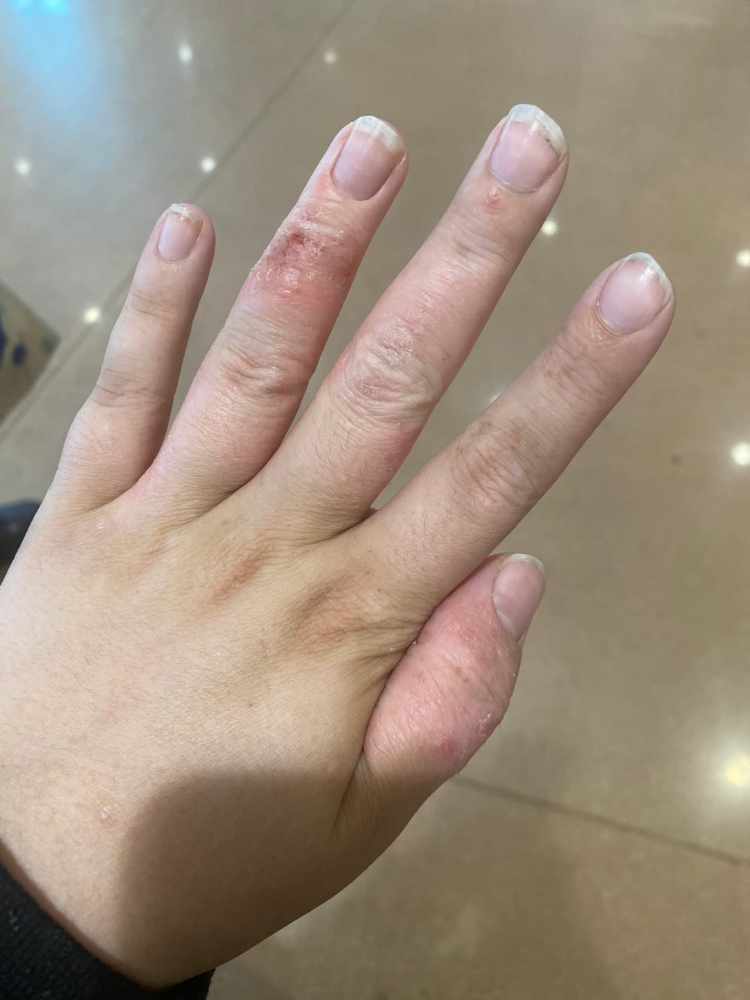 Customer photo review of Tallow and Honey Balm