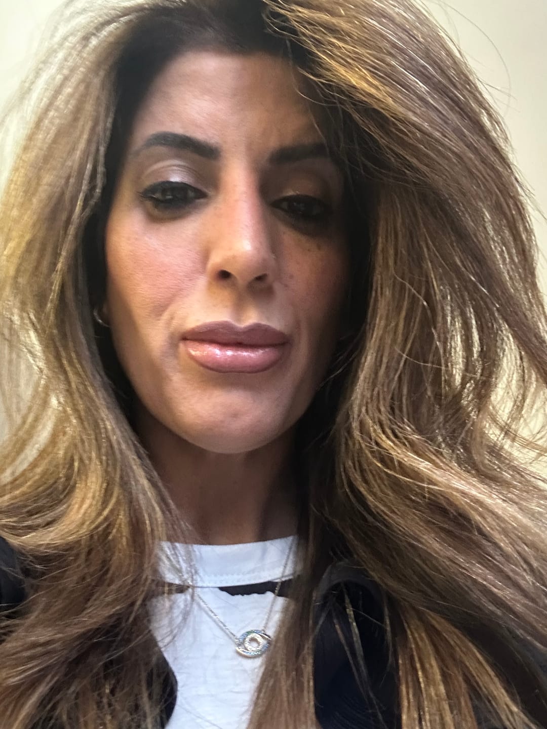 Customer photo review of Full Regrowth Kit™