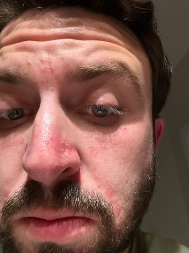 Customer photo review of Seb Natural Calming Serum
