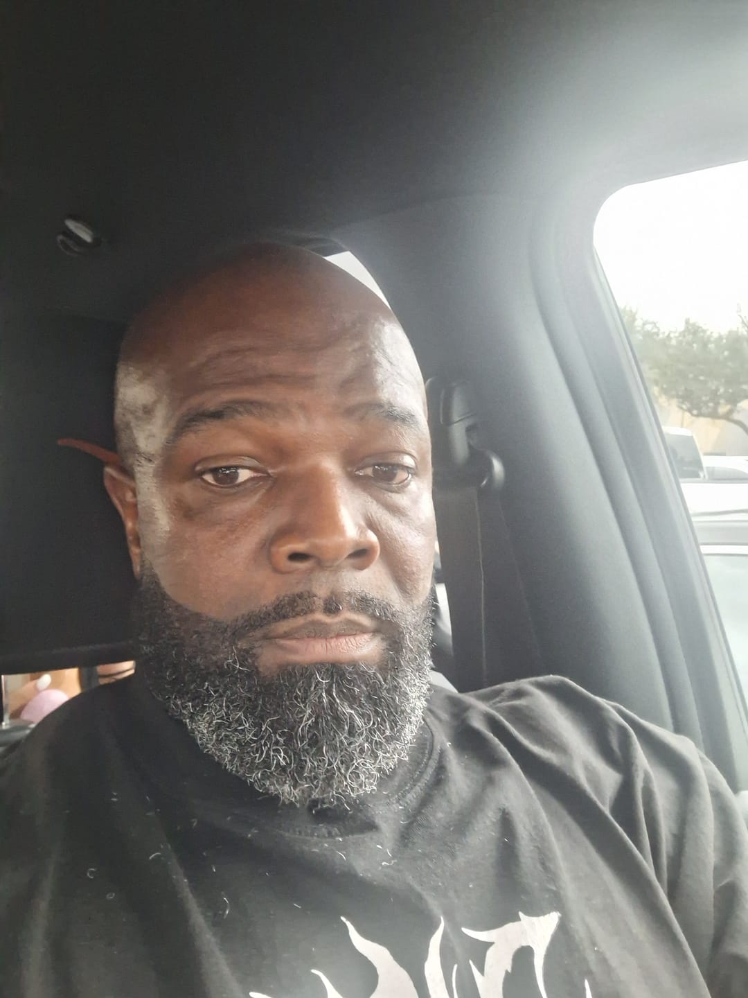 Customer photo review of Premium Hydration Kit