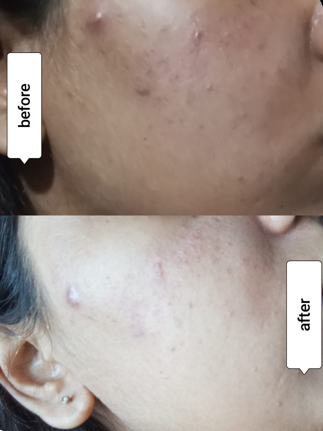 Customer photo review of Skin Rescue Mist