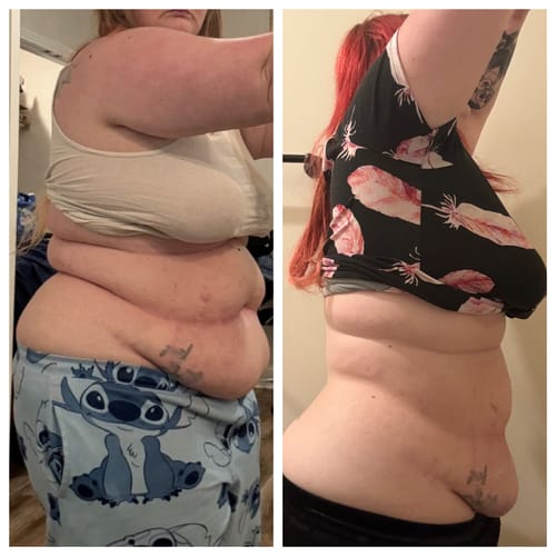 Customer photo review of GLP2Tirzp 10mg